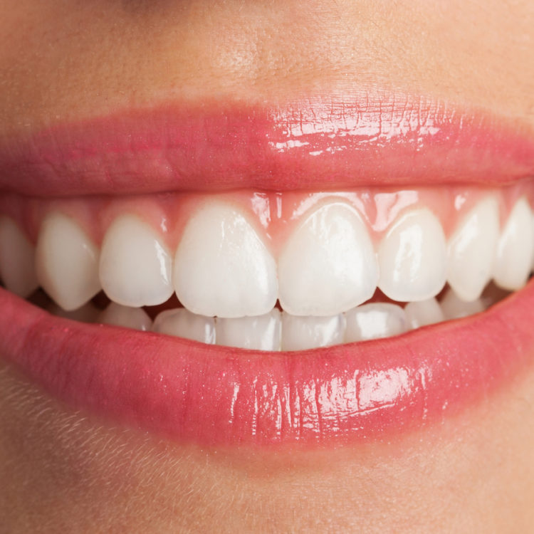 Closeup of a healthy smile